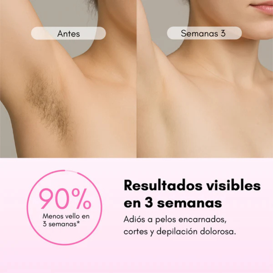 Depiladora Zanny IPL